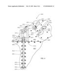 METHODS AND APPARATUS FOR REMOVAL AND CONTROL OF MATERIAL IN LASER DRILLING OF A BOREHOLE diagram and image