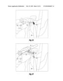 APPARATUS AND SYSTEMS FOR COUNTING CORN SILKS OR OTHER PLURAL ELONGATED STRANDS AND USE OF THE COUNT FOR CHARACTERIZING THE STRANDS OR THEIR ORIGIN diagram and image