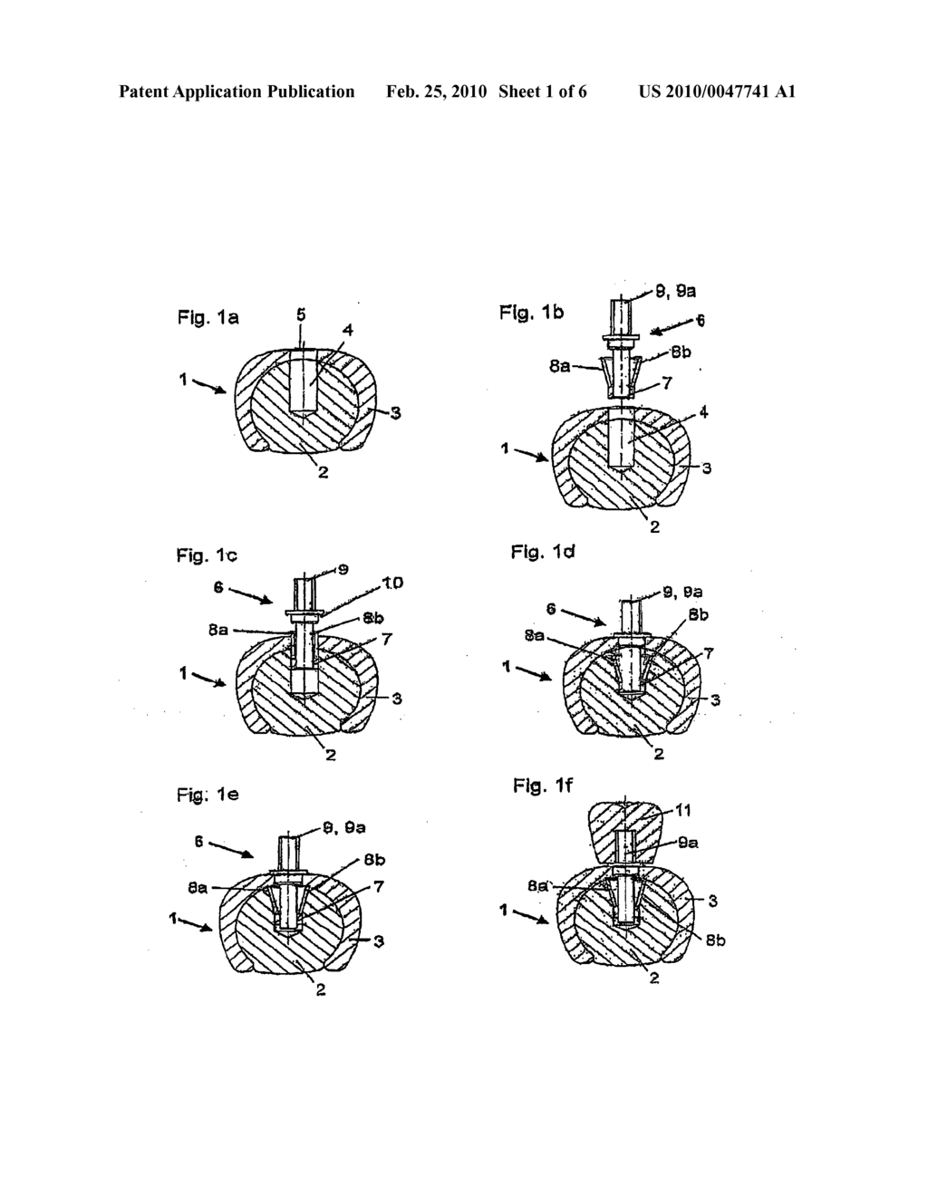 Dental Implant Carrier - diagram, schematic, and image 02