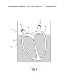 ANATOMICALLY AND FUNCTIONALLY ACCURATE SOFT TISSUE PHANTOMS AND METHOD FOR GENERATING SAME diagram and image