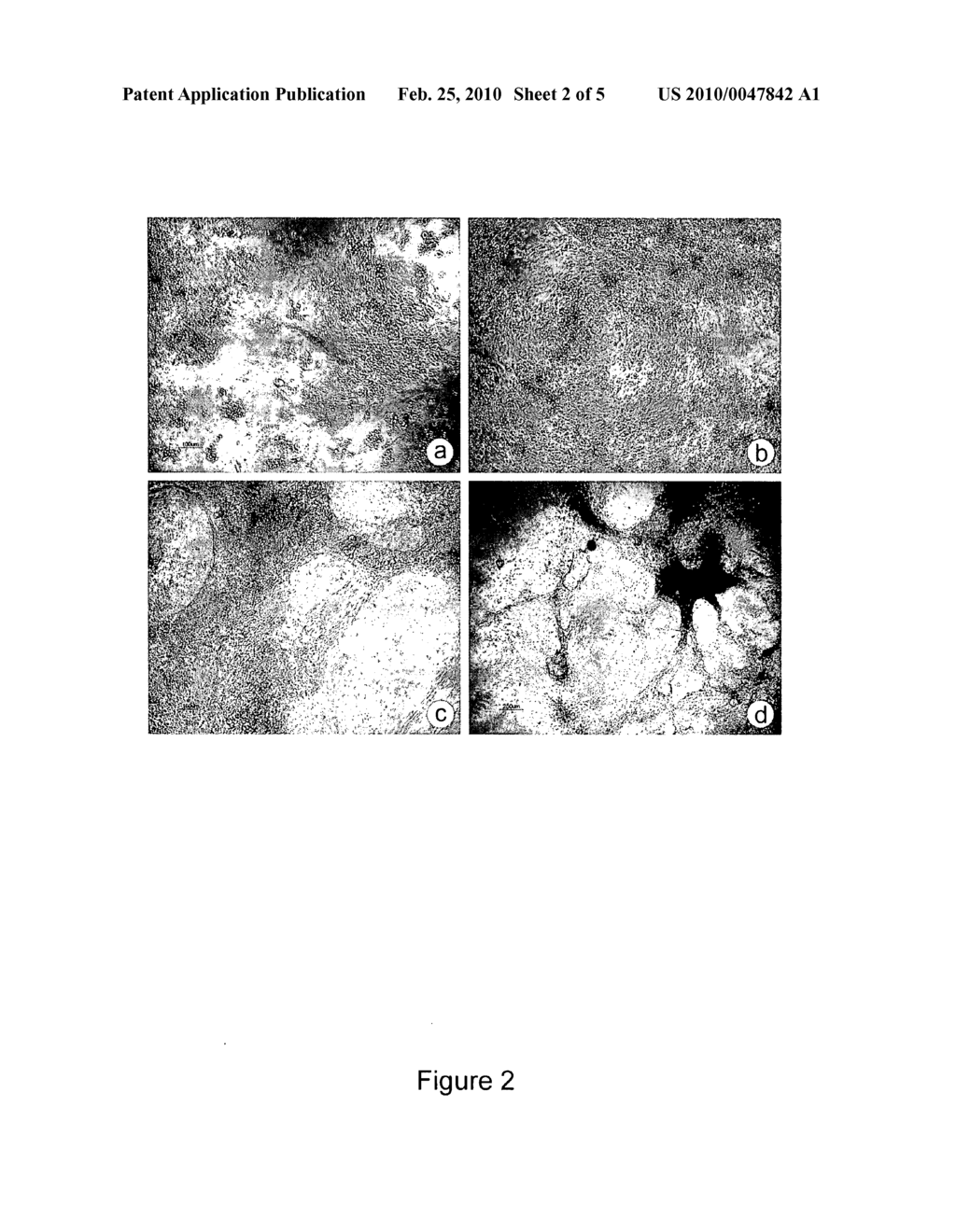 NOVEL TOXICITY ASSAY BASED ON HUMAN BLASTOCYST-DERIVED STEM CELLS AND PROGENITOR CELLS - diagram, schematic, and image 03