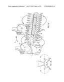 METHOD AND DEVICE FOR PROCESSING A CARCASS PART OF A SLAUGHTERED POULTRY diagram and image