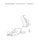 METHOD AND DEVICE FOR PROCESSING A CARCASS PART OF A SLAUGHTERED POULTRY diagram and image