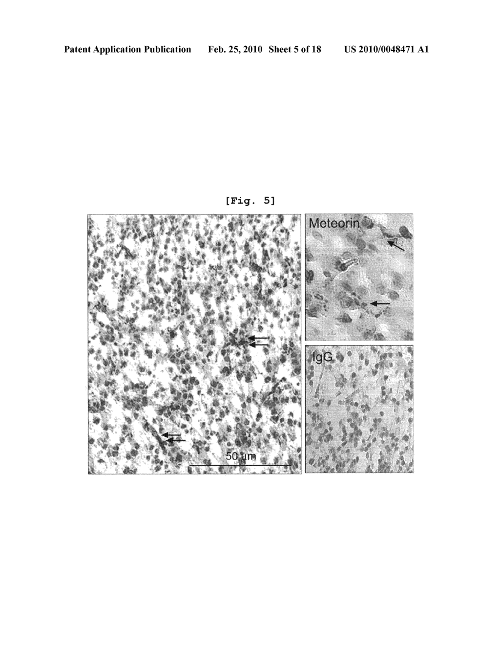 ANGIOGENESIS INHIBITOR COMPRISING METEORIN AS AN ACTIVE INGREDIENT - diagram, schematic, and image 06