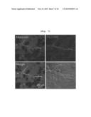 ANGIOGENESIS INHIBITOR COMPRISING METEORIN AS AN ACTIVE INGREDIENT diagram and image