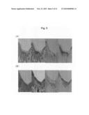 Composition for treating arthritic disorder diagram and image