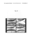 Composition for treating arthritic disorder diagram and image