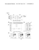 Role of miRNA in T cell leukemia diagram and image