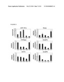 Role of miRNA in T cell leukemia diagram and image