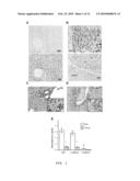 Non-androgen dependent roles for androgen receptor in liver cancer diagram and image