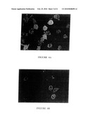 MACROCYCLIC DITERPENES FOR TREATING CONDITIONS ASSOCIATED WITH PROTEIN KINASE C diagram and image