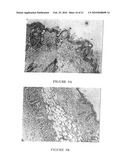 MACROCYCLIC DITERPENES FOR TREATING CONDITIONS ASSOCIATED WITH PROTEIN KINASE C diagram and image