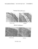 MACROCYCLIC DITERPENES FOR TREATING CONDITIONS ASSOCIATED WITH PROTEIN KINASE C diagram and image