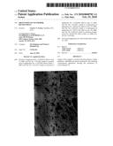 PREVENTION OF NEUTROPHIL RECRUITMENT diagram and image