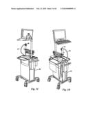 VIDEO ENDOSCOPE diagram and image