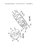 VIDEO ENDOSCOPE diagram and image