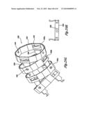 VIDEO ENDOSCOPE diagram and image