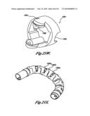 VIDEO ENDOSCOPE diagram and image