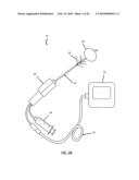 Non-Thermal Ablation System for Treating BPH and Other Growths diagram and image