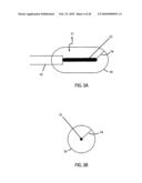 Non-Thermal Ablation System for Treating BPH and Other Growths diagram and image