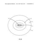 Non-Thermal Ablation System for Treating BPH and Other Growths diagram and image