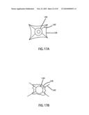 Non-Thermal Ablation System for Treating BPH and Other Growths diagram and image