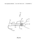 Non-Thermal Ablation System for Treating BPH and Other Growths diagram and image