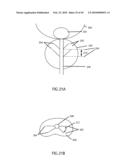 Non-Thermal Ablation System for Treating BPH and Other Growths diagram and image