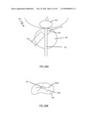 Non-Thermal Ablation System for Treating BPH and Other Growths diagram and image