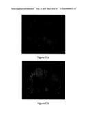 Non-Thermal Ablation System for Treating BPH and Other Growths diagram and image