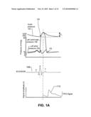 IMPLANTABLE HEMODYNAMIC MONITOR AND METHODS FOR USE THEREWITH diagram and image