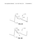 IMPLANTABLE HEMODYNAMIC MONITOR AND METHODS FOR USE THEREWITH diagram and image