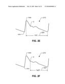 IMPLANTABLE HEMODYNAMIC MONITOR AND METHODS FOR USE THEREWITH diagram and image