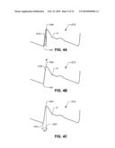 IMPLANTABLE HEMODYNAMIC MONITOR AND METHODS FOR USE THEREWITH diagram and image