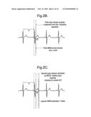 BIOMEDICAL SIGNAL MORPHOLOGY ANALYSIS METHOD diagram and image