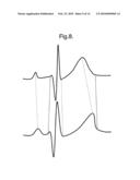 BIOMEDICAL SIGNAL MORPHOLOGY ANALYSIS METHOD diagram and image