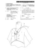 Systems and methods for applying audible acoustic energy to increase tissue perfusion and/or vasodilation diagram and image