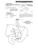 ELECTRICAL ABLATION DEVICES diagram and image