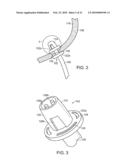 ELECTRICAL ABLATION DEVICES diagram and image