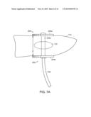 ELECTRICAL ABLATION DEVICES diagram and image