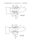 ELECTRICAL ABLATION DEVICES diagram and image