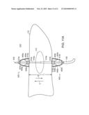 ELECTRICAL ABLATION DEVICES diagram and image