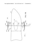 ELECTRICAL ABLATION DEVICES diagram and image