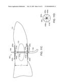 ELECTRICAL ABLATION DEVICES diagram and image