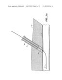 SHEATH-MOUNTED ARTERIAL PLUG DELIVERY DEVICE diagram and image