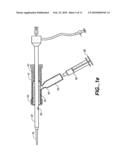 SHEATH-MOUNTED ARTERIAL PLUG DELIVERY DEVICE diagram and image