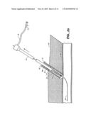 SHEATH-MOUNTED ARTERIAL PLUG DELIVERY DEVICE diagram and image