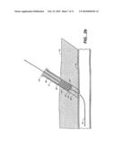 SHEATH-MOUNTED ARTERIAL PLUG DELIVERY DEVICE diagram and image