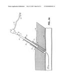 SHEATH-MOUNTED ARTERIAL PLUG DELIVERY DEVICE diagram and image