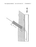 SHEATH-MOUNTED ARTERIAL PLUG DELIVERY DEVICE diagram and image